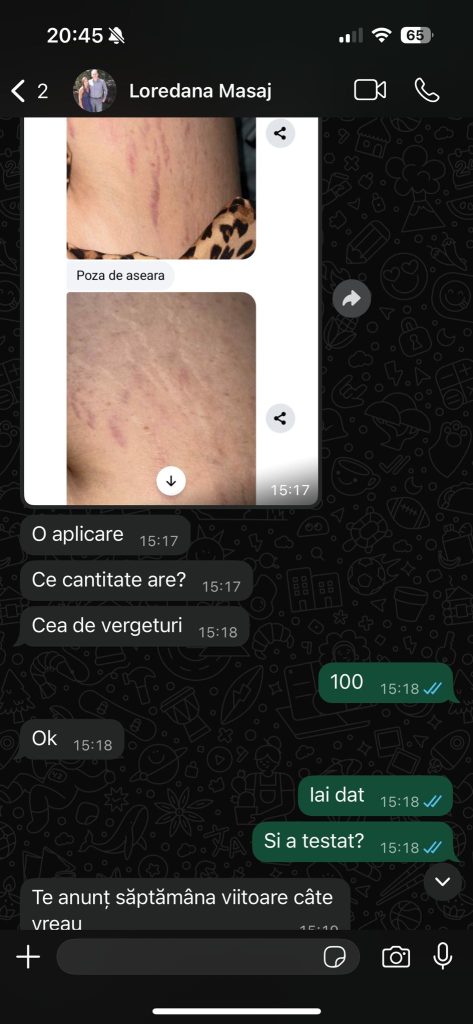 Mama DermaLift – Cremă Naturală Anti-Vergeturi Post-Sarcină (2)